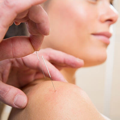 PMC Specialisaties | Dry needling